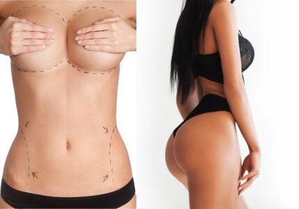 Breasts, Butts, and the Truth Behind Cosmetic Enhancements
