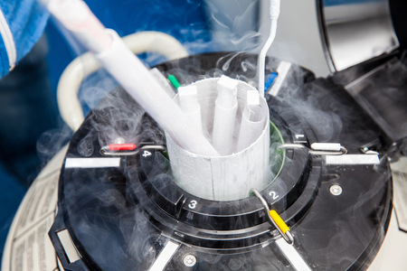 Sperm Donation - Cryogenic Tank